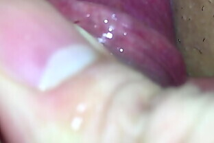 Vân Anh - 2nd time so she still gets hurt