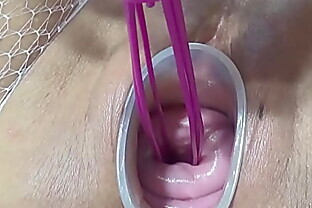 Mature wife fucking cervix and penetration in uterus with knifes