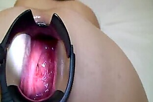 Gaping anal speculum stretching and dildo fuck