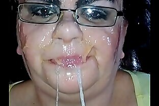 Ms TL throat